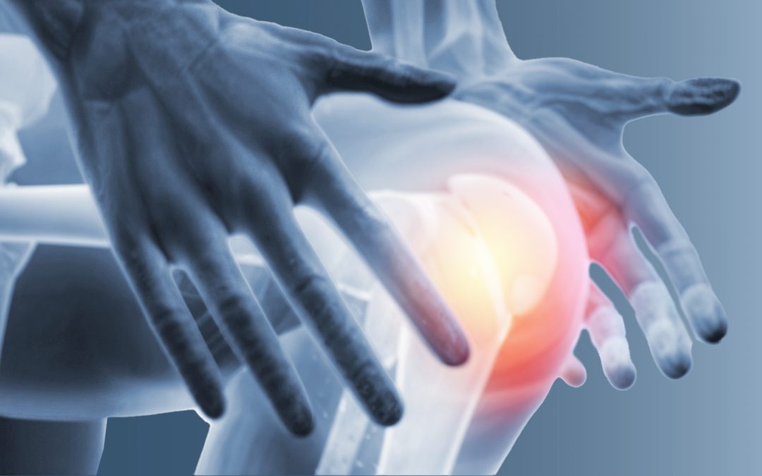 Arthrose