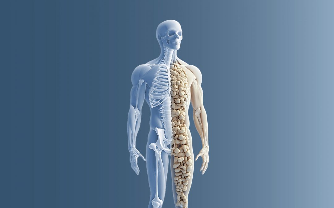 Osteoporose